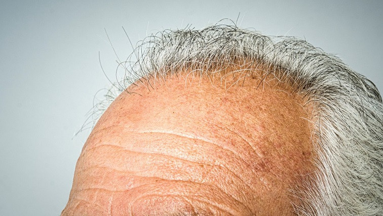 Coaxing Hair Growth in Aging Hair Follicle Stem Cells