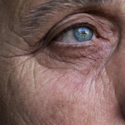 A Novel Biosensor for Detecting Neurogenerative Disease Proteins