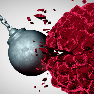 Tiny Nanospindles Enhance Use of Ultrasound to Fight Cancer
