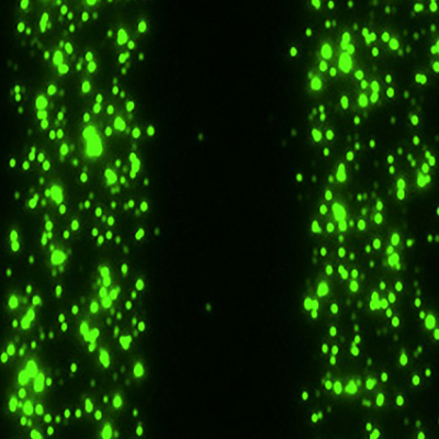 Watch Cells Trek along Vesicle ‘Breadcrumbs’