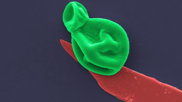 Superbug Killer: New Nanotech Destroys Bacteria and Fungal Cells