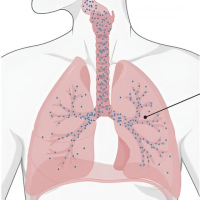 An mRNA COVID Vaccine (And Potentially More) with Nanoparticles, No Shot Needed