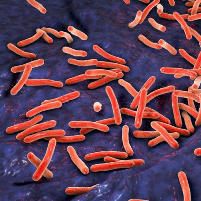 Breathing New Life into TB Treatment with Inhalable Nanomedicine