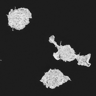 Not Just A Messenger: Developing Nano-sized Delivery Agents That Also Provide Therapeutic Treatment