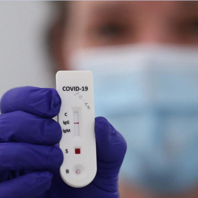 SLINTEC Seeks Emergency Approval for Cost and Time Efficient COVID-19 Test Kit