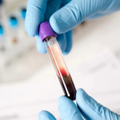 Blood Test Could Make Cancer Treatments Safer and More Effective