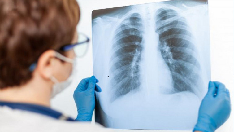 Interaction with Lung Cells Transforms Asbestos Particles