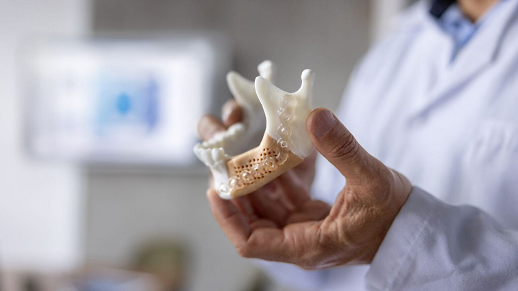 A New Bone Substitute MadeO ut of … 3D-Printed Glass?