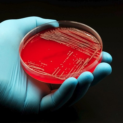 New Species of Bacteria Discovered in Unusual Human Infection
