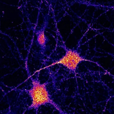 Polymer Library for RNA-based Therapeutic Approaches