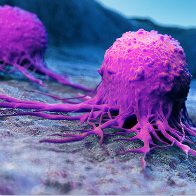 Custom Nanoparticle Regresses Tumors When Exposed to Light