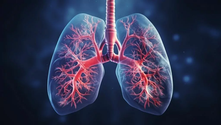 Detecting Evidence of Lung Cancer in Exhaled Breath