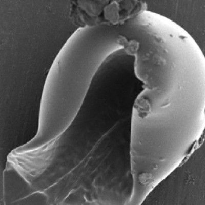 Cracking the Shell to Unlock New Frontiers in Microbiome Research