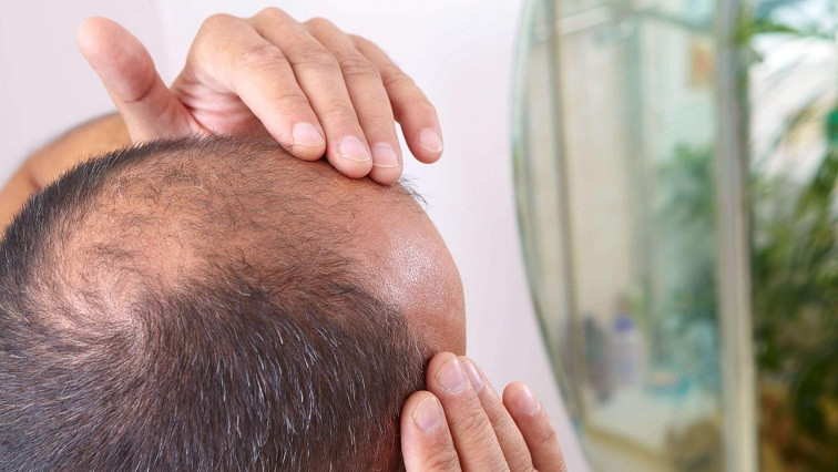 Treating the ‘Root’ Cause of Baldness with a Dissolvable Microneedle Patch