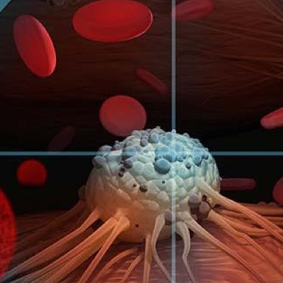 Targeting Cancer at the Nanoscale