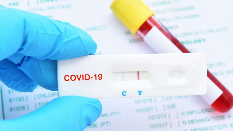 Coronavirus-like Particles Could Ensure Reliability of Simpler, Faster COVID-19 Tests