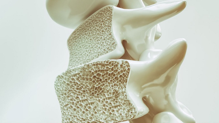 Using Nanoscience to Treat Osteoporosis