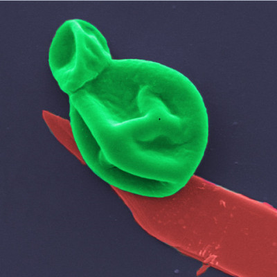 Superbug Killer: New Nanotech Destroys Bacteria and Fungal Cells