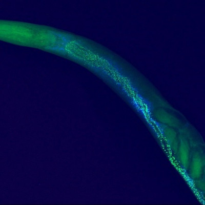 Full-body Synchrotron Imaging of Roundworms Reveals Nanoparticle Accumulation