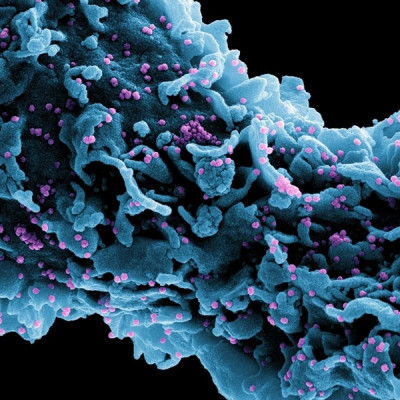 Nanotechnology Provides Novel Solutions Against Zoonotic Viruses