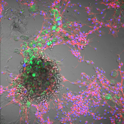 Nanoplastics Detected in Animal Cells – FBN Study Warns of Possible Consequences