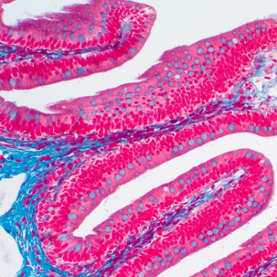 Nano-scale Biosensor Lets Scientists Monitor Molecules in Real Time