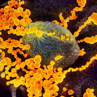 Nanoparticles Cast New Light on Mysterious Coronavirus, Treatment Is Around the Corner