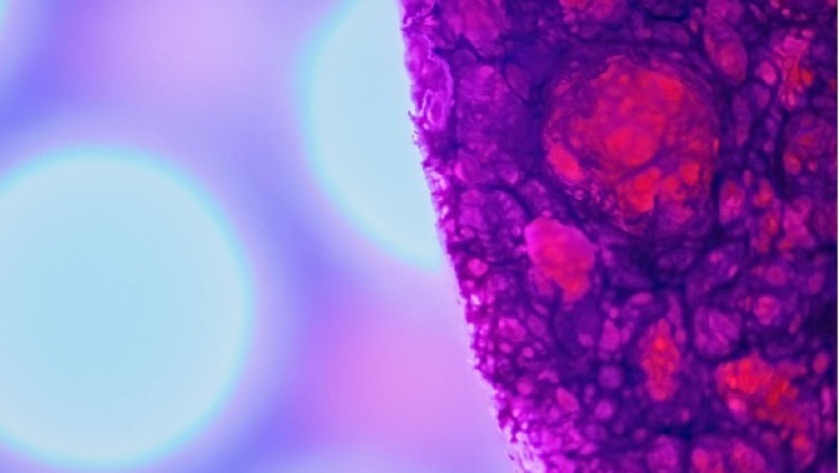 New Method Hoosts Control and Separation of Tiny Particles – A Promising Tool for Medical Research