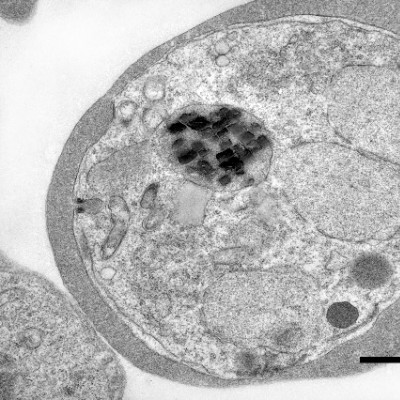 Malaria Parasites are Full of Wildly Spinning Iron Crystals. Scientists Finally Know Why.