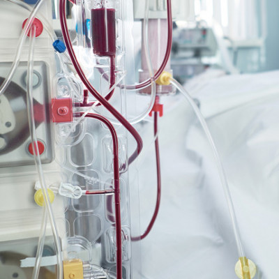Vanderbilt Team Reimagines Kidney Dialysis by Creating New Paradigm for Dialysis Membranes