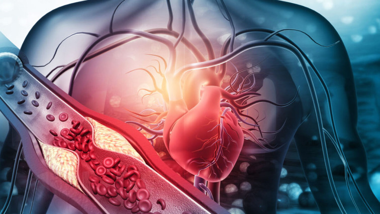 Possible Breakthrough in Cardiovascular Disease Diagnostics for Europe and the European Union
