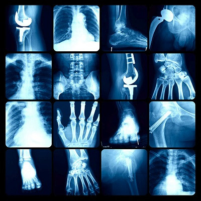 Picture Perfect X-Ray Capture