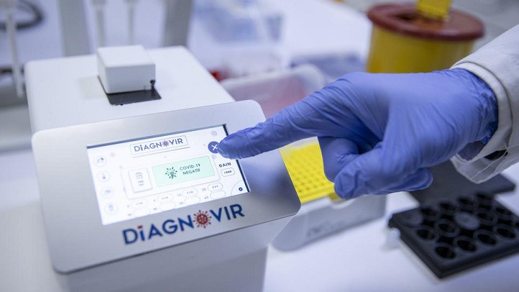Turkish Scientists Develop COVID-19 Test to Replace PCR
