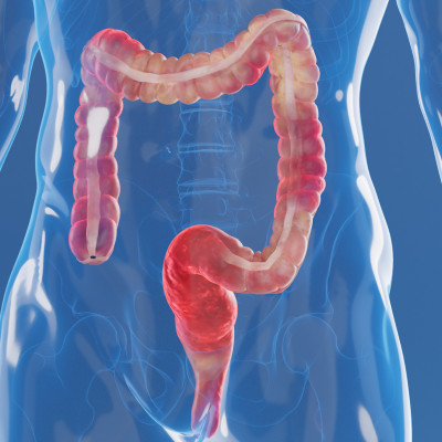 Fluorescence Gives Doctors a Real-time Connection with the Health of the Gut