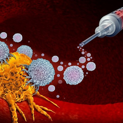 Personalized Tumor Vaccines May Solve Tumor Recurrence and Metastasis Challenges