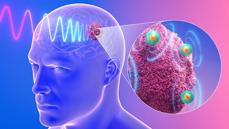 Injectable Nanodevices Could Provide Effective Treatment for Drug-resistant Glioblastoma