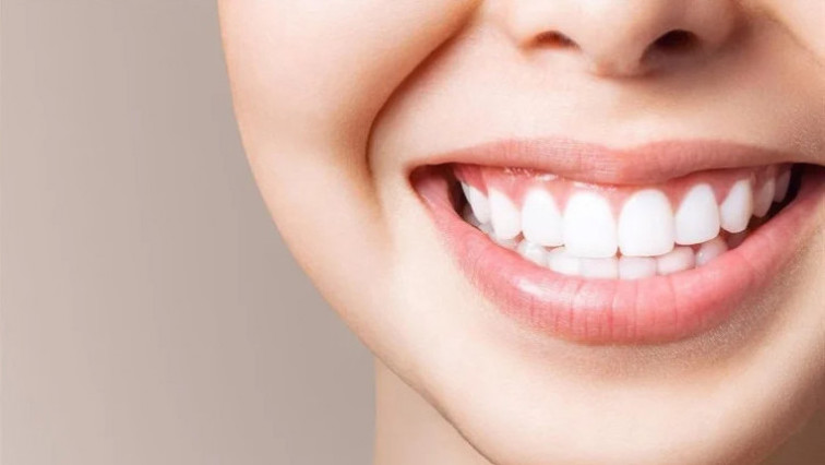 Nanoparticles May Be the Next-generation Solution for Teeth Whitening