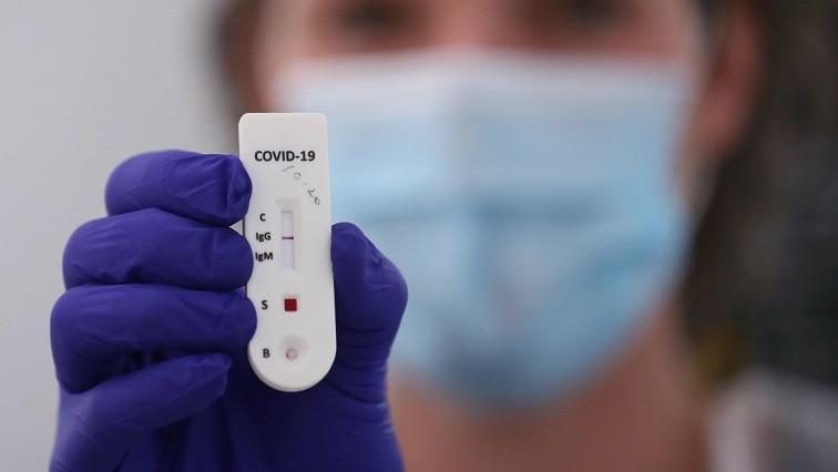 New Rapid Test to Detect Coronavirus Antibodies Developed