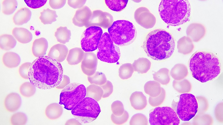 New Ultra-Long Circulating Nanoparticle Developed for Chronic Myeloid Leukemia