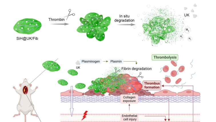Scientists Develop Novel Nanothrombolytic Strategy