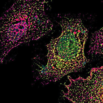 New Way to Improve the Efficacy of Innovative RNA Therapies
