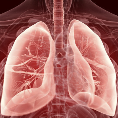 A Lung Injury Therapy Derived from Adult Skin Cells