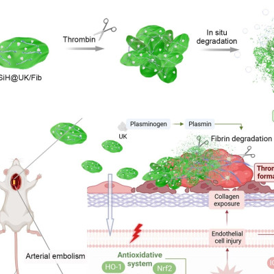 Scientists Develop Novel Nanothrombolytic Strategy
