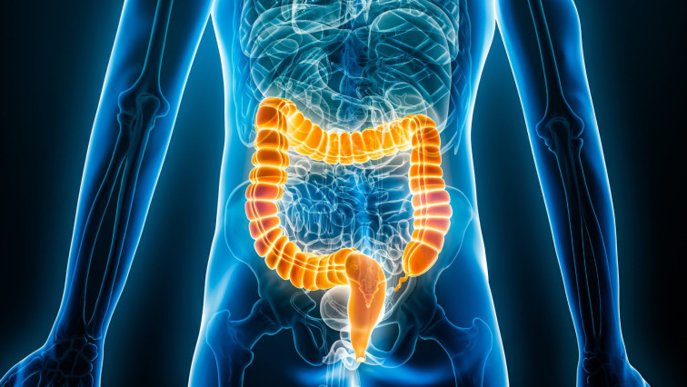 Oral Lipid Nanoparticle Drug Can Prevent Development of Colitis-associated Cancer, Researchers Find