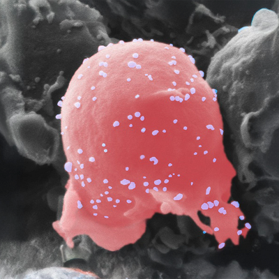 Developing a New Multiple Sclerosis Treatment