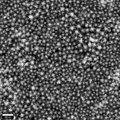 Light-and-sound-based Thermometer Helps Gold Nanoparticles Destroy Cancer