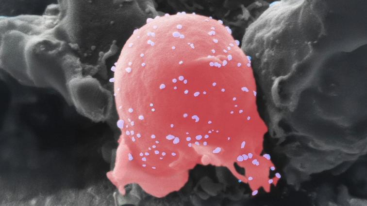 Developing a New Multiple Sclerosis Treatment