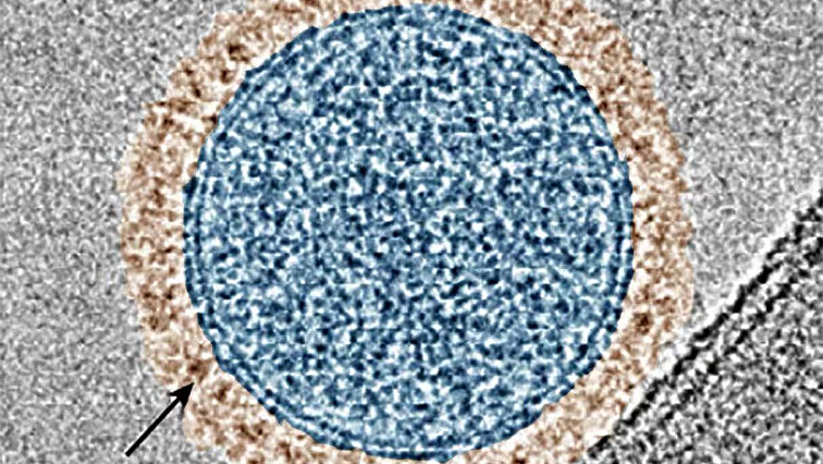 Inhalable Therapy Aims for One-Two Punch Against Advanced Melanoma