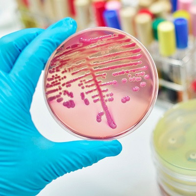 New Antimicrobial Therapeutics to Fight Superbugs