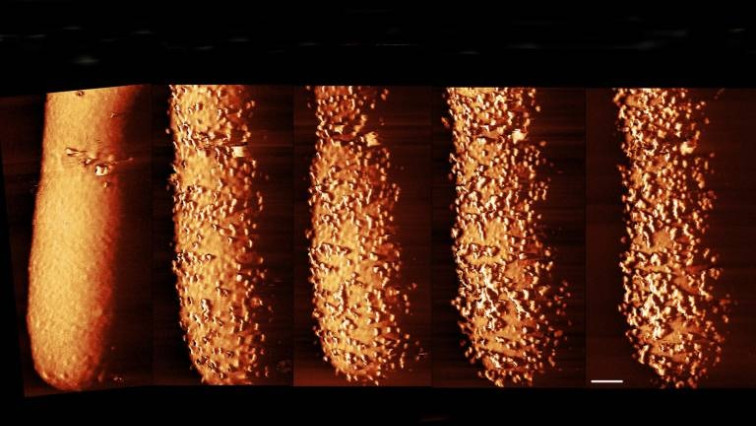 Startling Images Show How Antibiotic Pierces Bacteria’s Armour